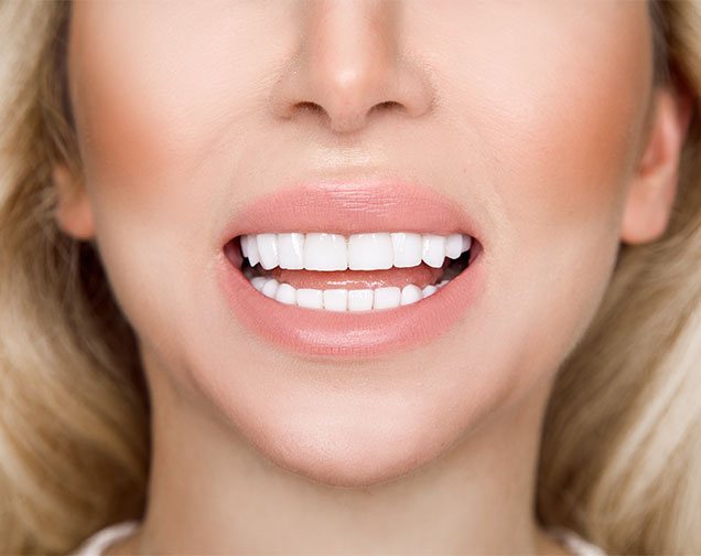 Porcelain Veneers Needs | Kelowna General & Family Dentist | Brookside Dental Centre | Kelowna, BC